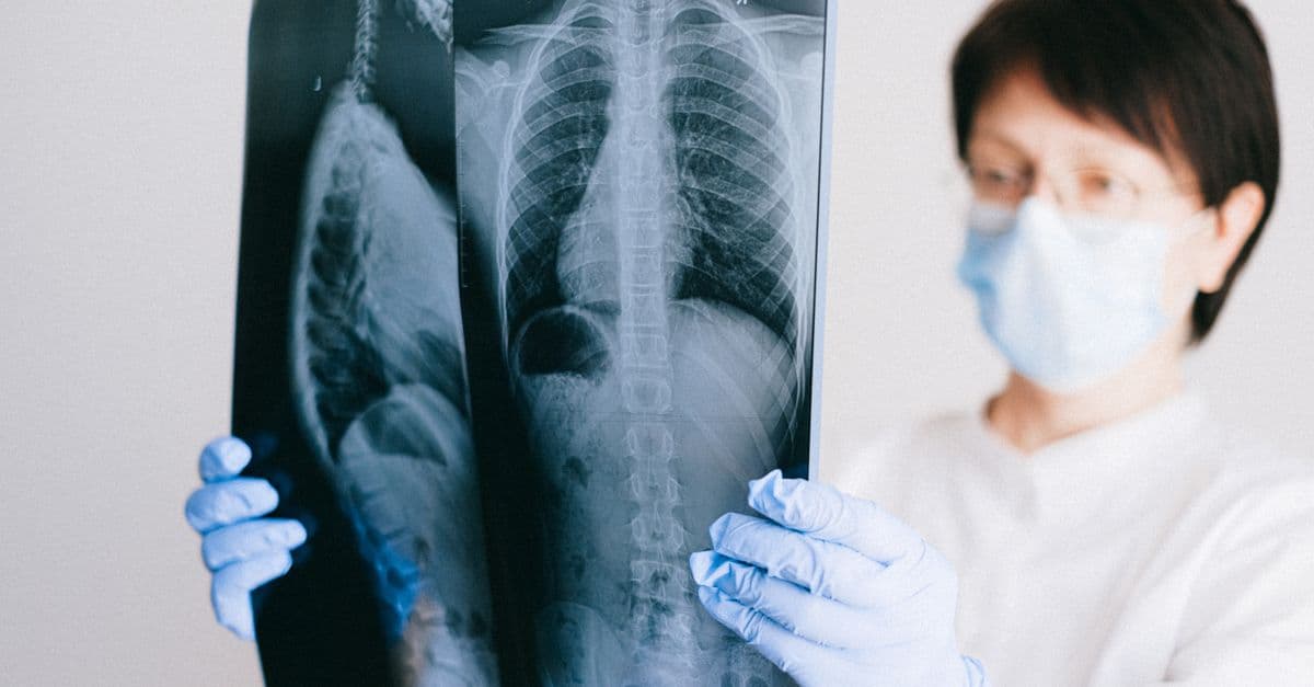 Revolutionizing Healthcare: The Role of AI in Early Disease Detection